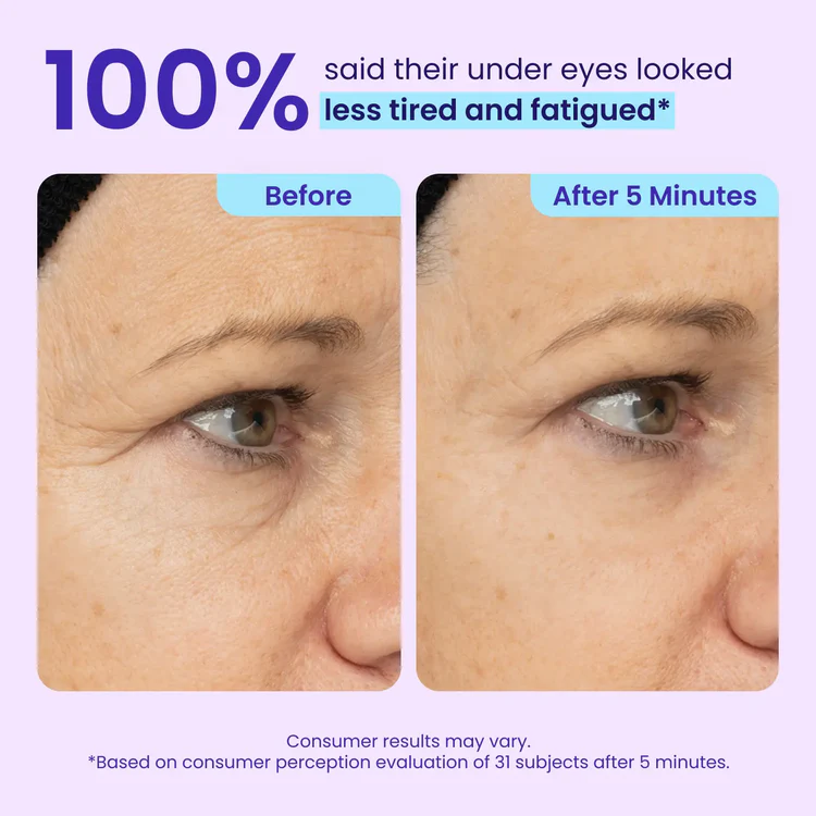 Drivika®Instant Lift Eye Gel — Reduce the Look of Eye Bags in Minutes ✨