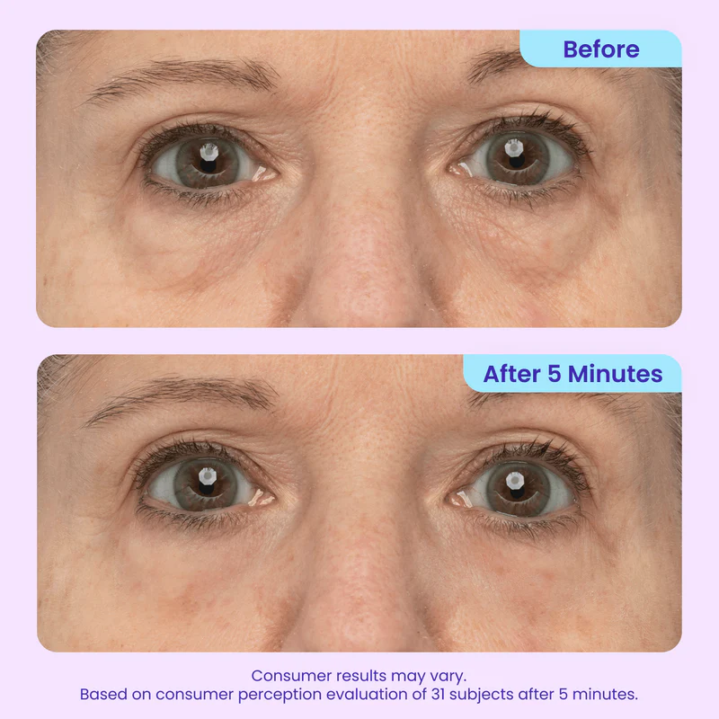 Drivika®Instant Lift Eye Gel — Reduce the Look of Eye Bags in Minutes ✨