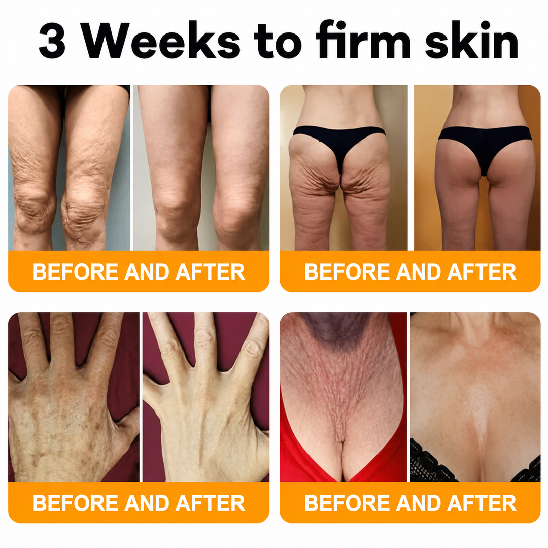 Made and Shipped from USA 💖💖Drivika® Bee Venom Comprehensive Cream LAST DAY 80% OFF(Sagging Skin, Fine Lines, Loss of Firmness, Flat Bust, Drooping Hips, and More)