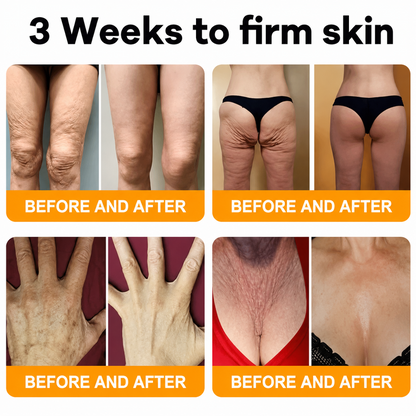 Made and Shipped from USA 💖💖Drivika® Bee Venom Comprehensive Cream LAST DAY 80% OFF(Sagging Skin, Fine Lines, Loss of Firmness, Flat Bust, Drooping Hips, and More)