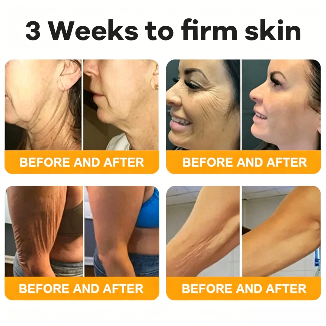 Made and Shipped from USA 💖💖Drivika® Bee Venom Comprehensive Cream LAST DAY 80% OFF(Sagging Skin, Fine Lines, Loss of Firmness, Flat Bust, Drooping Hips, and More)