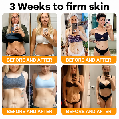 Made and Shipped from USA 💖💖Drivika® Bee Venom Comprehensive Cream LAST DAY 80% OFF(Sagging Skin, Fine Lines, Loss of Firmness, Flat Bust, Drooping Hips, and More)