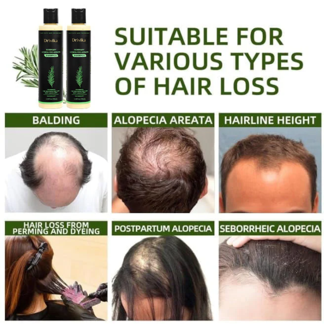 🔥LAST DAY 50% OFF - 🌿Drivika® Organic Rosemary Hair Growth Shampoo