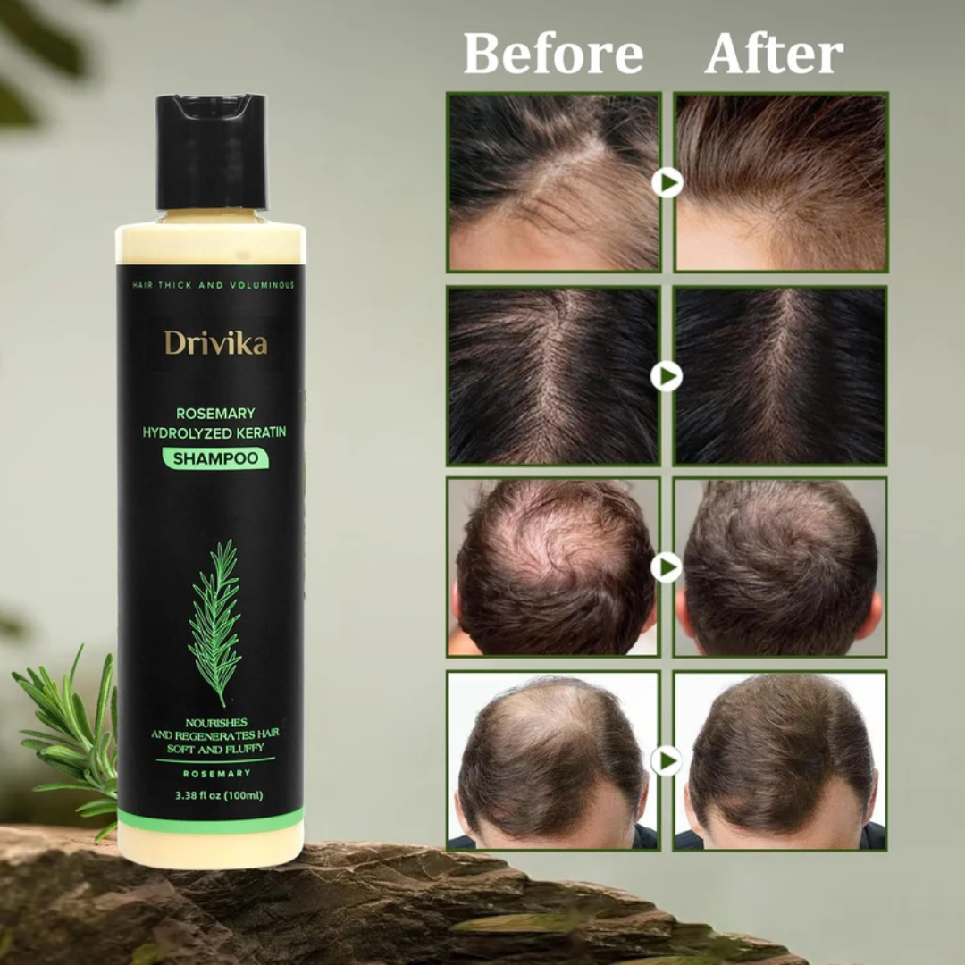 🔥LAST DAY 50% OFF - 🌿Drivika® Organic Rosemary Hair Growth Shampoo