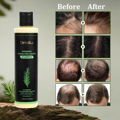 🔥LAST DAY 50% OFF - 🌿Drivika® Organic Rosemary Hair Growth Shampoo