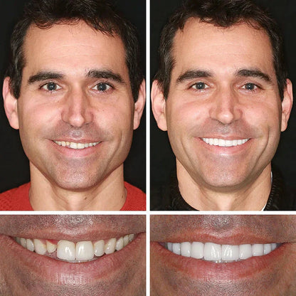 2026 NEW Upgraded 2.0🏆🌎Ends Today: 70% OFF! ⏰Drivika™ Medical Full Denture with Strong Suctiond🦷Obtain American Dental Association (ADA) Certification