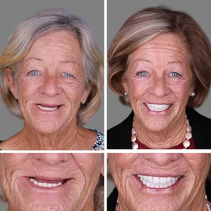 2026 NEW Upgraded 2.0🏆🌎Ends Today: 70% OFF! ⏰Drivika™ Medical Full Denture with Strong Suctiond🦷Obtain American Dental Association (ADA) Certification