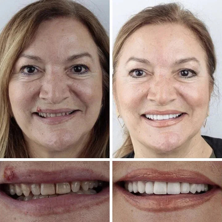 2026 NEW Upgraded 2.0🏆🌎Ends Today: 70% OFF! ⏰Drivika™ Medical Full Denture with Strong Suctiond🦷Obtain American Dental Association (ADA) Certification
