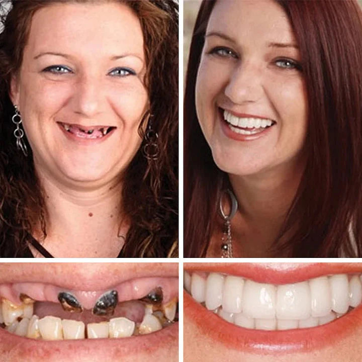 2026 NEW Upgraded 2.0🏆🌎Ends Today: 70% OFF! ⏰Drivika™ Medical Full Denture with Strong Suctiond🦷Obtain American Dental Association (ADA) Certification