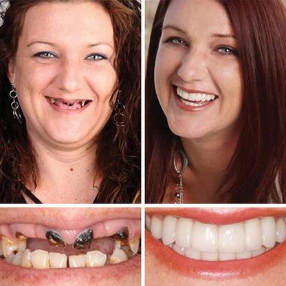 2026 NEW Upgraded 2.0🏆🌎Ends Today: 70% OFF! ⏰Drivika™ Medical Full Denture with Strong Suctiond🦷Obtain American Dental Association (ADA) Certification