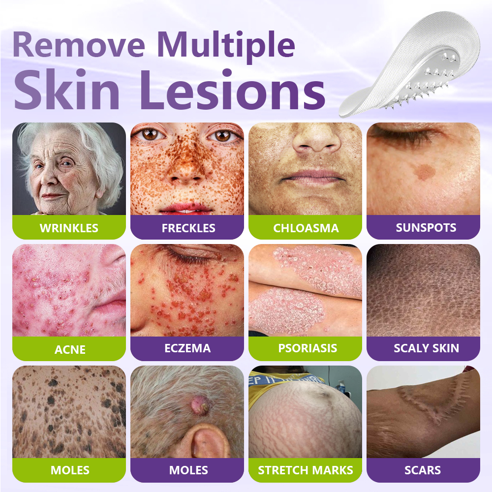 Drivika® Soluble Microneedle Botanical Skin Tag Removal Patch